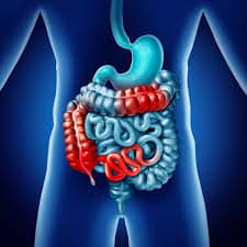 crohn